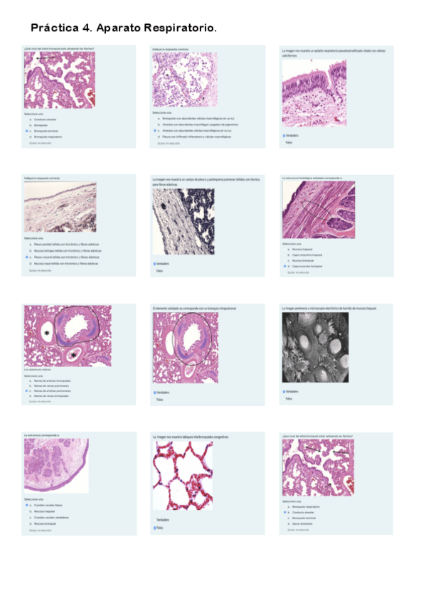 Miniatura del documento Práctica 4. Cuestionario Aparato Respiratorio.pdf