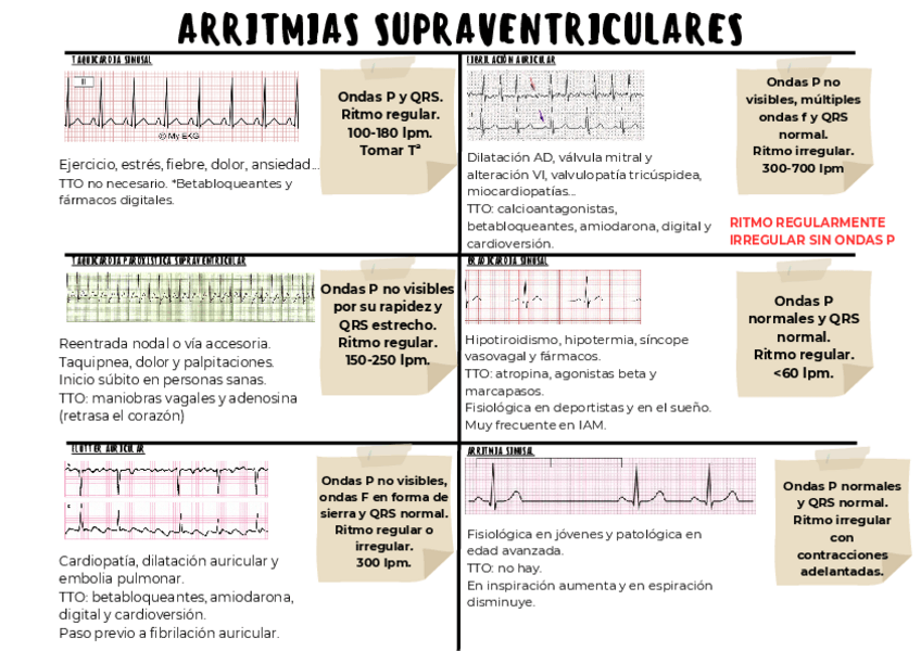 Miniatura del documento CUADRO-ARRITMIAS.pdf