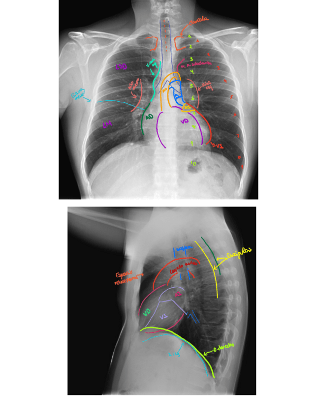 Miniatura del documento Identificar-anatomia-en-Rx.pdf