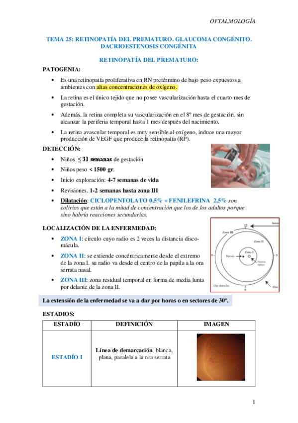 Miniatura del documento T25-Retinopatia-del-prematuro.-Glaucoma-congenito.-Dacrioestenosis.pdf