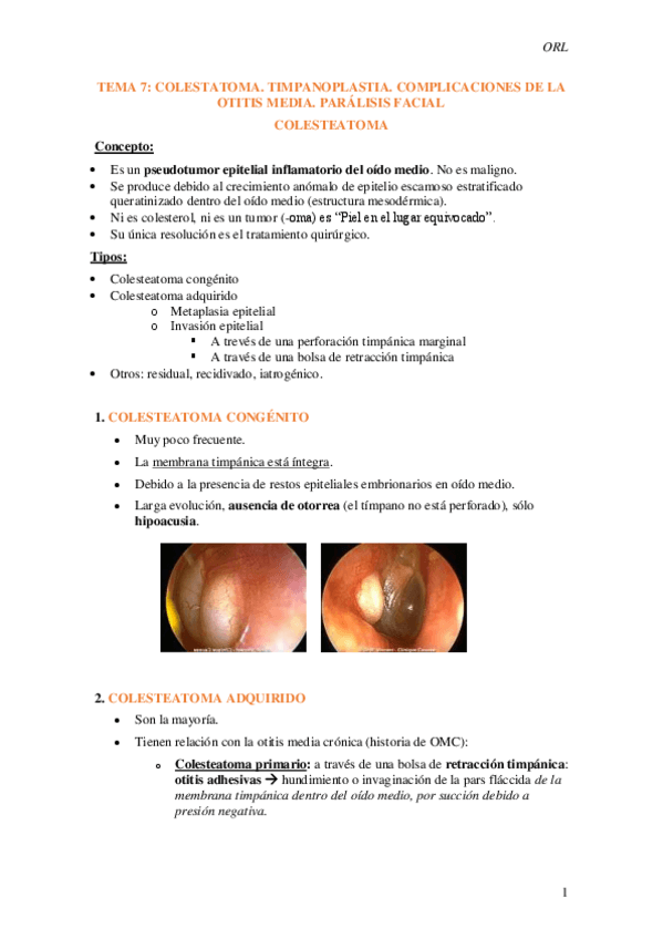 Miniatura del documento Tema-7.-Colestatoma.-Timpanoplastias.-Complicaciones-de-la-OM.-Paralisis-facial.pdf