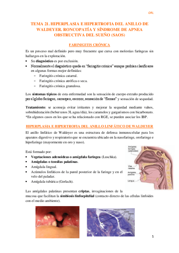 Miniatura del documento Tema-21.-SAOS.pdf