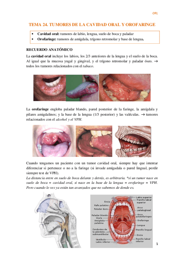 Miniatura del documento Tema-23-Cancer-cavidad-oral-y-orofaringe.pdf