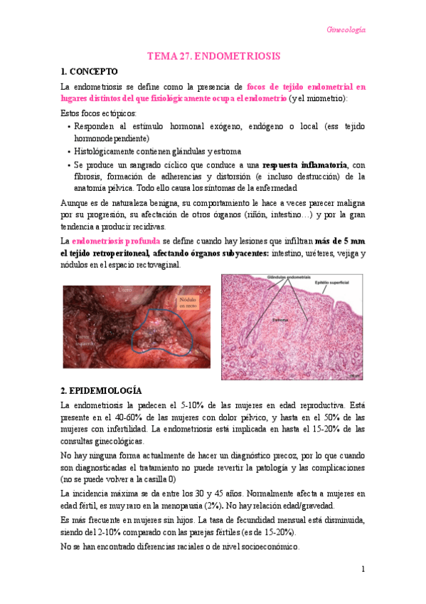 Miniatura del documento T27-Endometriosis.pdf