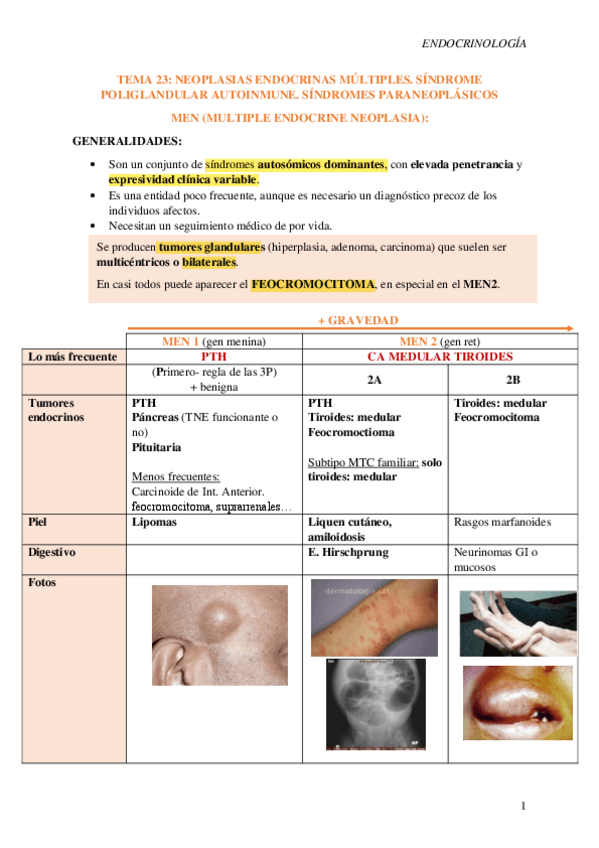 Miniatura del documento Tema-23-MEN-S.poliglandular-IA-S.paraneoplasicos.pdf