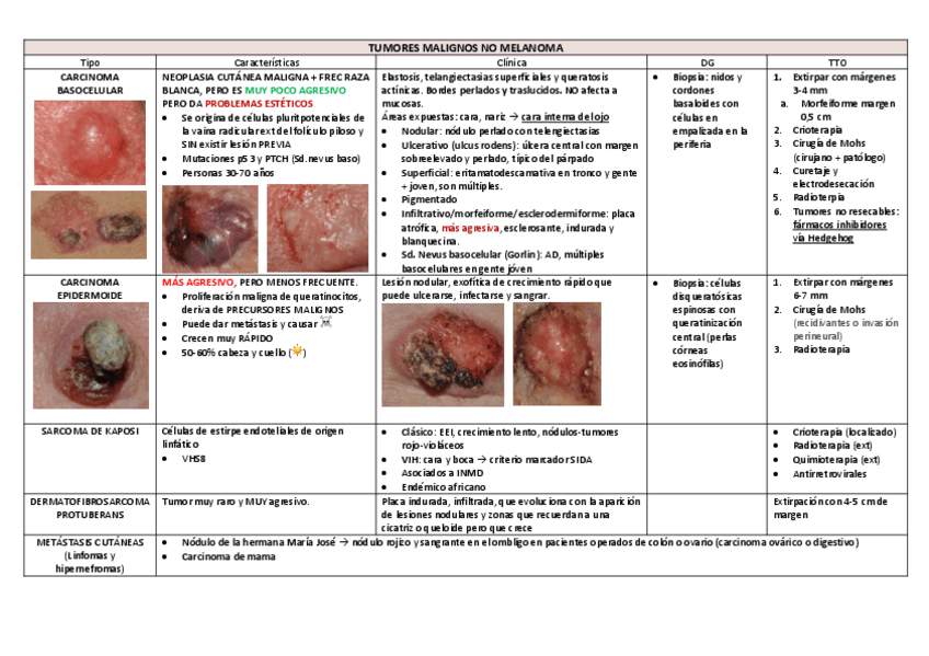 Miniatura del documento TUMORES-MALIGNOS-NO-MELANOMA.pdf