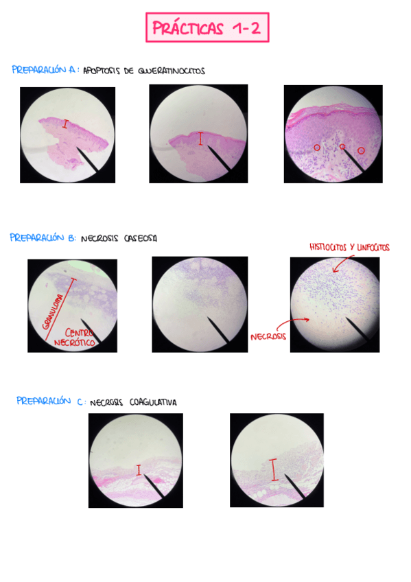 Miniatura del documento FOTOS PREPARACIONES (1º CUATRI).pdf