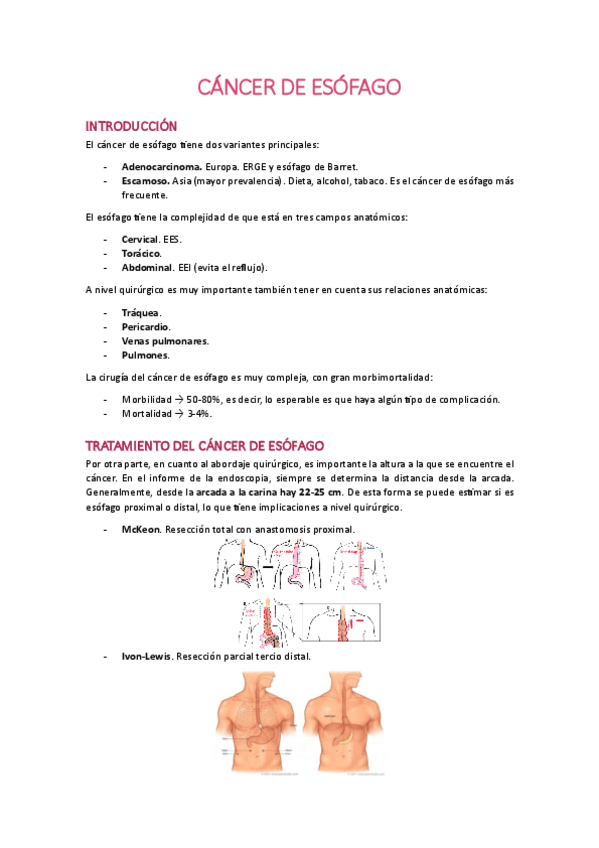 Miniatura del documento CANCER-DE-ESOFAGO.pdf
