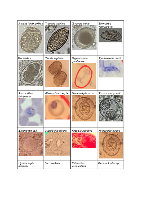 Miniatura del documento Resumen-practicas-de-parasitologia.pdf