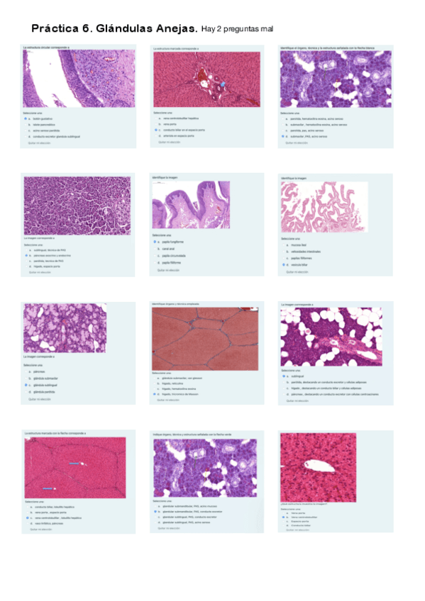 Miniatura del documento Práctica 6. Cuestionario Glándulas Anejas.pdf