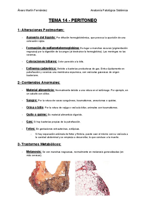 Miniatura del documento TEMA-14-PERITONEO.pdf