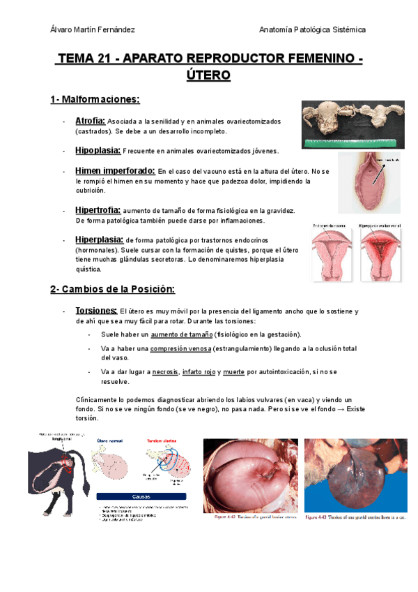 Miniatura del documento TEMA-21-APARATO-REPRODUCTOR-FEMENINO-UTERO.pdf