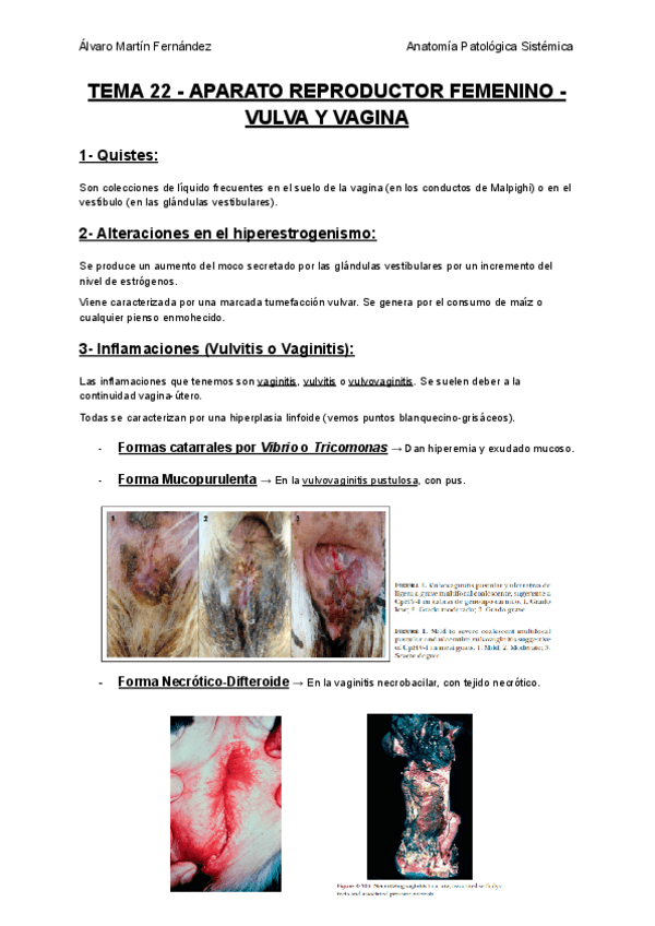 Miniatura del documento TEMA-22-APARATO-REPRODUCTOR-FEMENINO-VULVA-Y-VAGINA.pdf