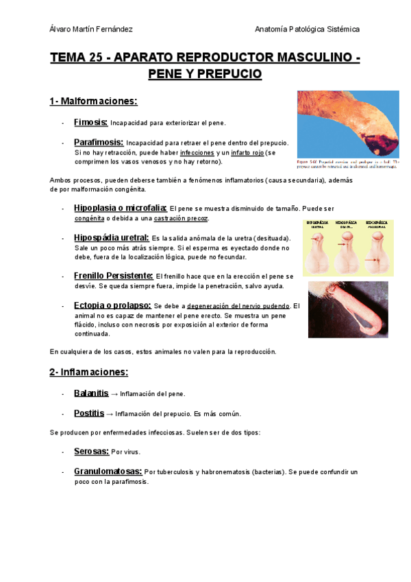 Miniatura del documento TEMA-25-APARATO-REPRODUCTOR-MASCULINO-PENE-Y-PREPUCIO.pdf