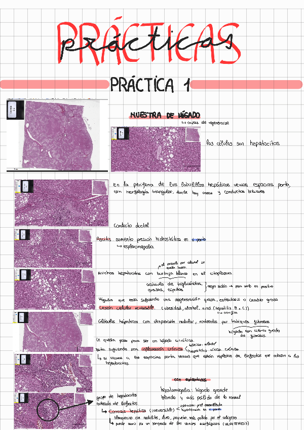 Miniatura del documento PRACTICAS-ANATOMIA-PATOLOGICA.pdf