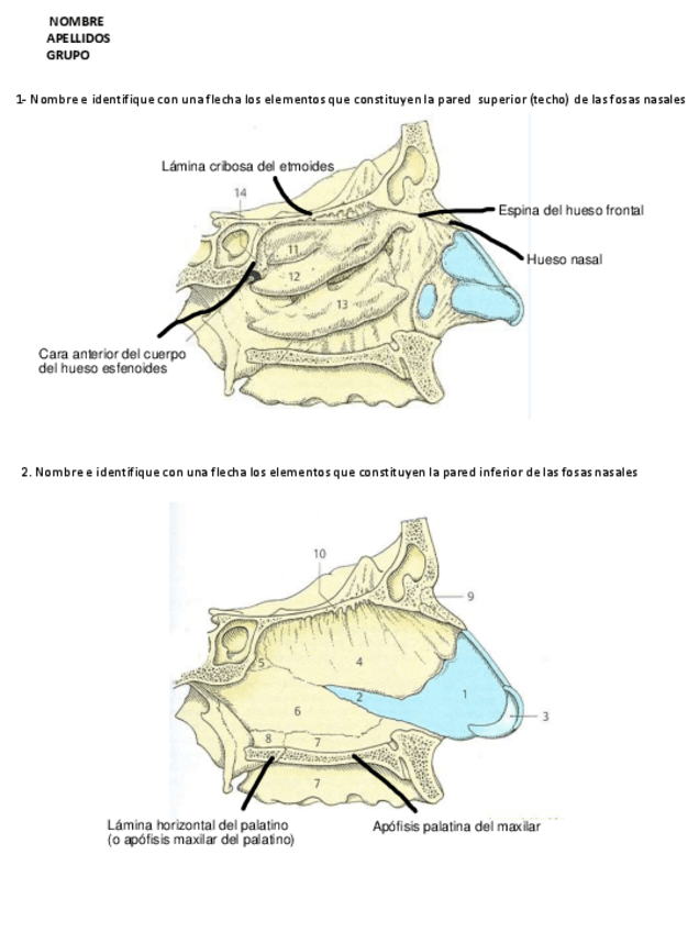 Miniatura del documento Laminas-Practica-2-Fosas-nasales-y-senos-paranasales.pdf