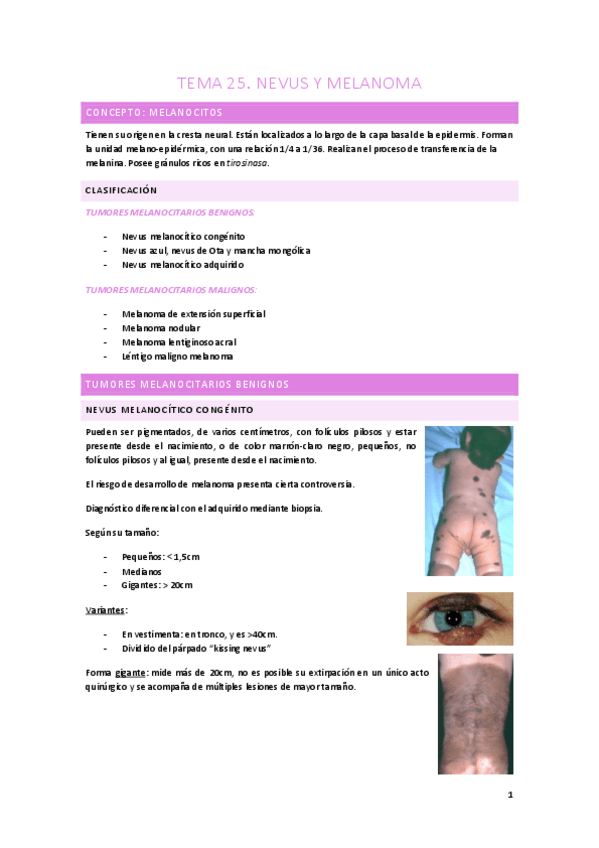 Miniatura del documento tema-25-nevus-y-melanoma.pdf