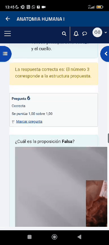 Miniatura del documento EXAMEN CYC.MP4