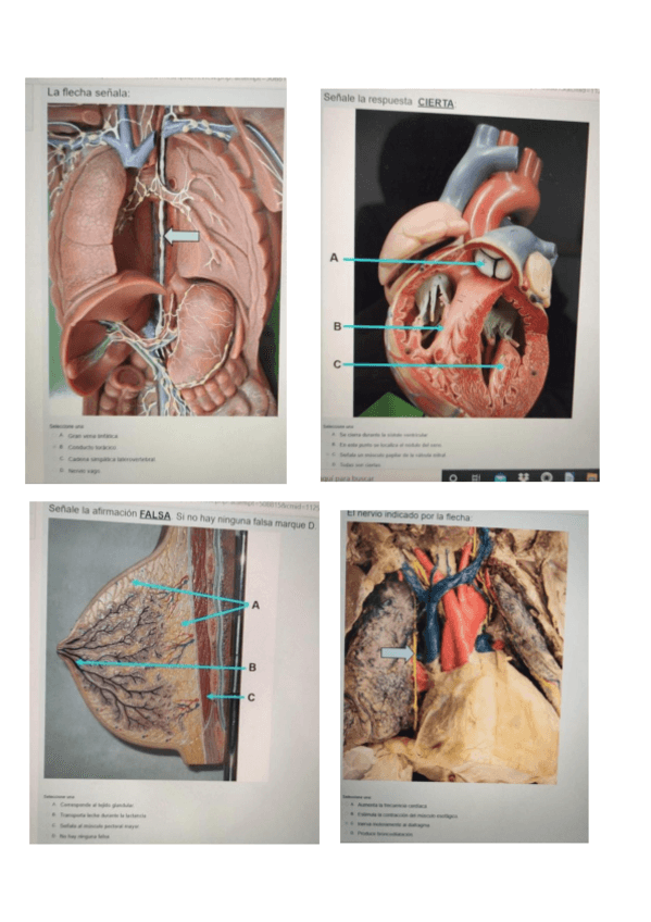 Miniatura del documento Esxamen-parcial-torax.pdf