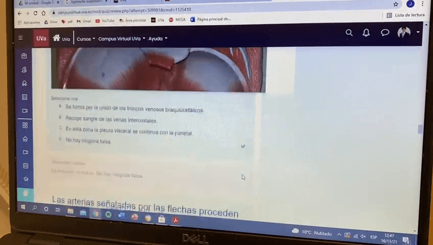 Miniatura del documento EXAMEN-PARCIAL-TORAX.MP4