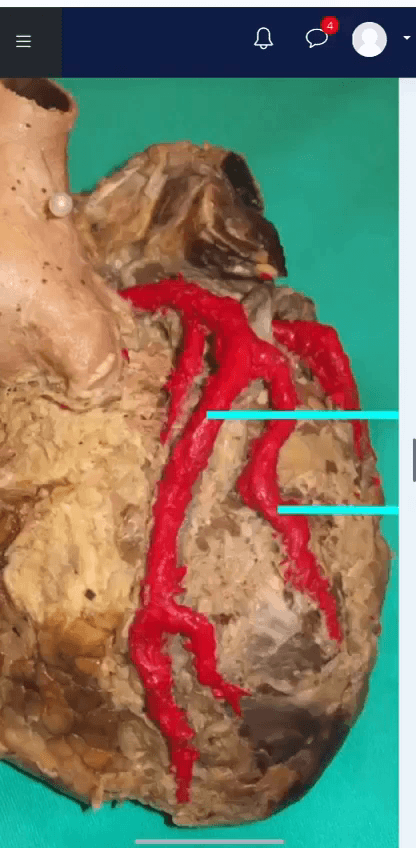 Miniatura del documento EXAMEN-PARCIAL-TORAX.MP4