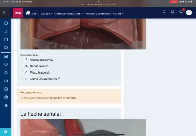 Miniatura del documento EXAMEN-PARCIAL-TORAX.MP4