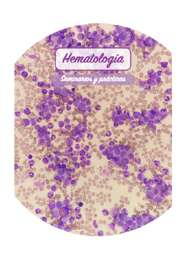 Miniatura del documento Seminarios-hematologia.pdf