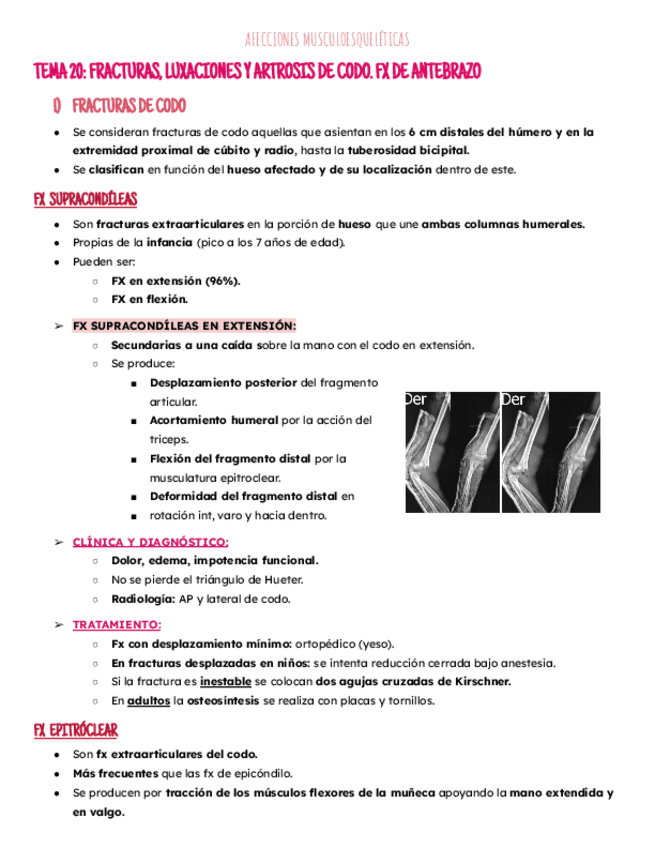 Miniatura del documento Tema 20: fx-lux. de codo.pdf