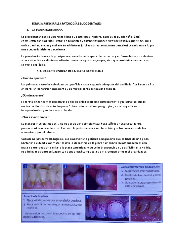 Miniatura del documento RESUMEN-T3-TAO-PATOLOGIAS-BUCODENTALES.pdf