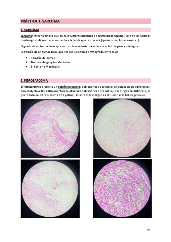 Miniatura del documento 3. Sarcoma.pdf