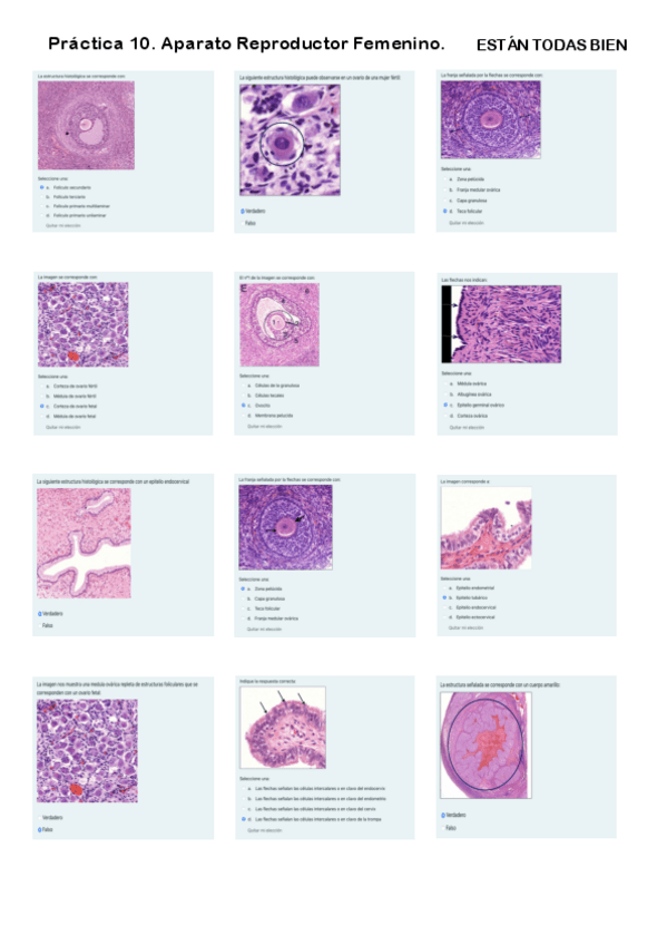 Miniatura del documento Práctica 10. Cuestionario Aparato Reproductor Femenino.pdf