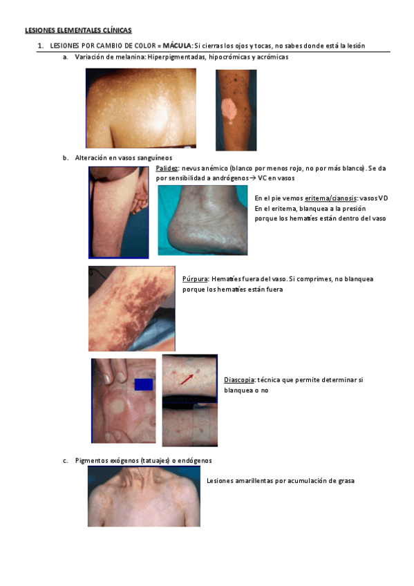 Miniatura del documento LESIONES-ELEMENTALES.pdf