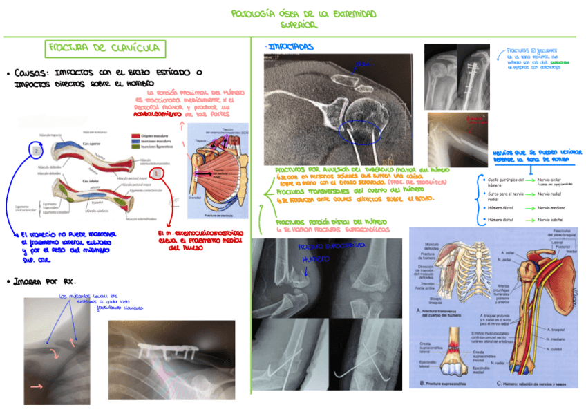 Miniatura del documento Patologia-osea-de-la-extremidad-superiorEsquema.pdf