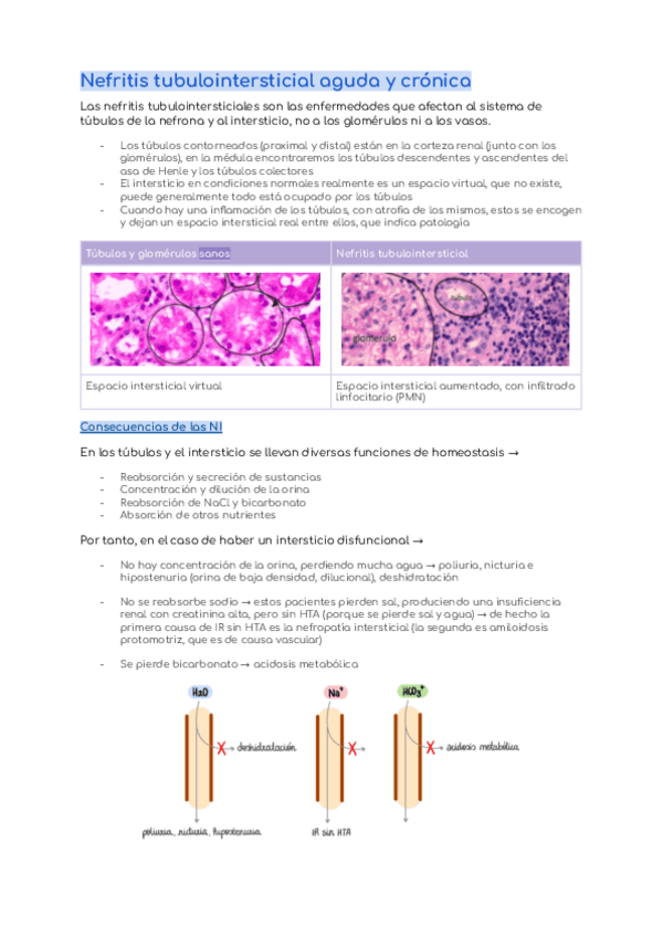 Miniatura del documento Nefritis-tubulointersticial-aguda-y-cronica.pdf