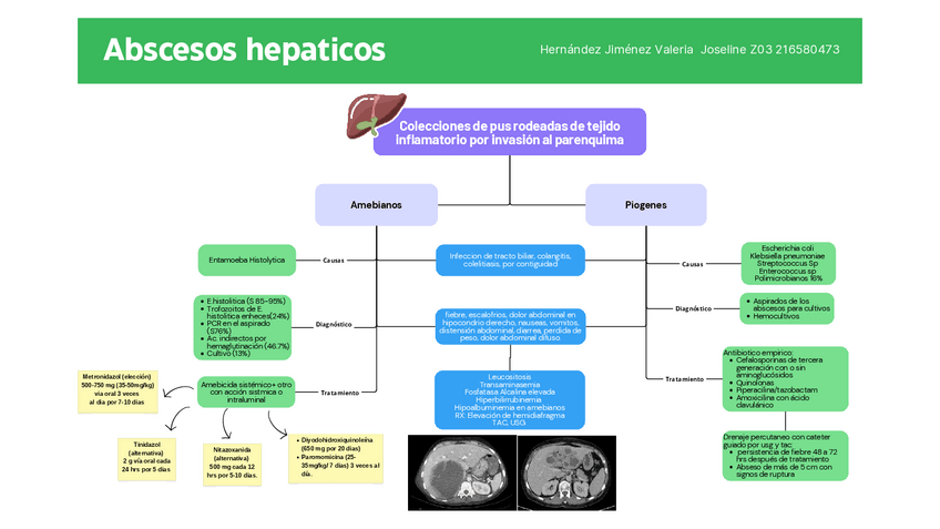 Miniatura del documento Abscesos-hepaticos.pdf
