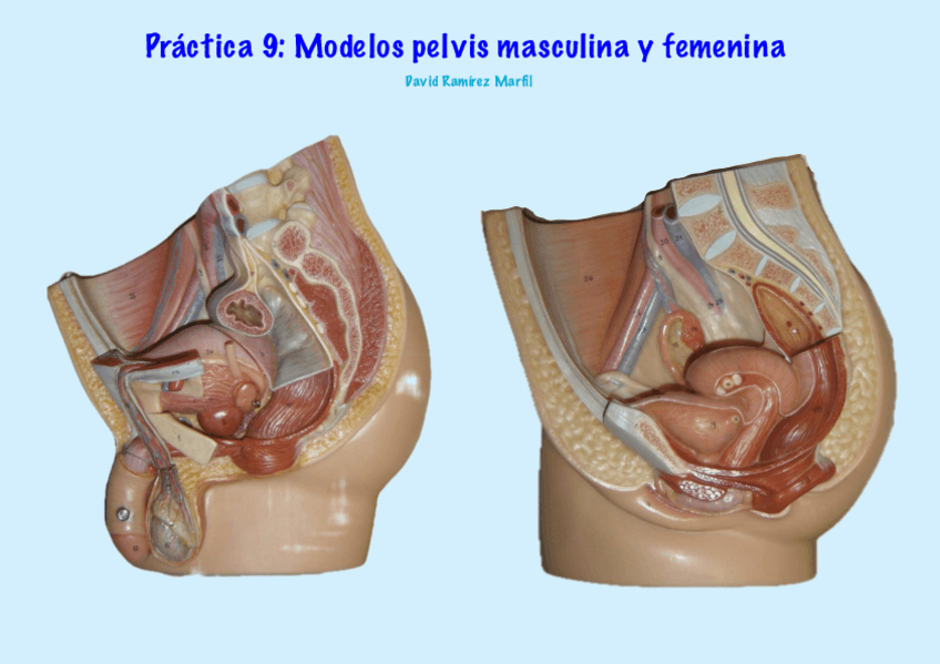Miniatura del documento Practica-9.-Modelos-Pelvis-Masculina-Y-Femenina.pdf