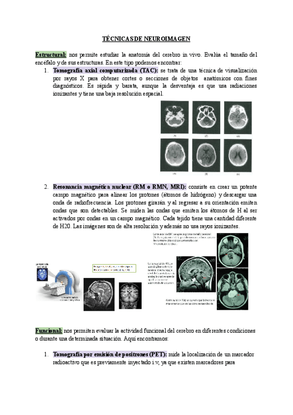 Miniatura del documento TECNICAS-DE-NEUROIMAGEN.pdf