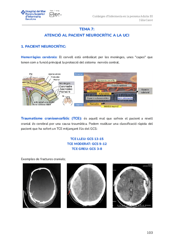 Miniatura del documento Tema-7.-Atencio-al-pacient-neurocritic-a-la-UCI.pdf