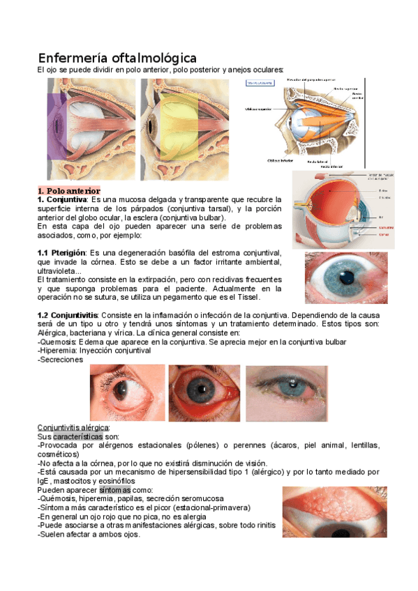 Miniatura del documento Enfermeria-oftalmologica.pdf