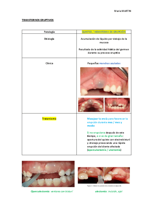 Miniatura del documento .TRANSTORNOS-ERUPTIVOS.pdf