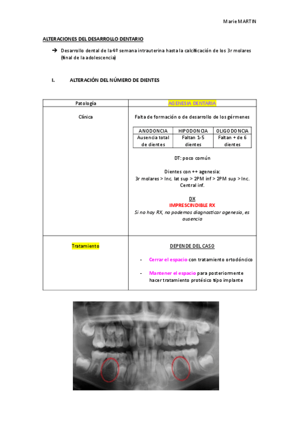 Miniatura del documento .ALTERACIONES-DEL-DESARROLLO-DENTARIO.pdf