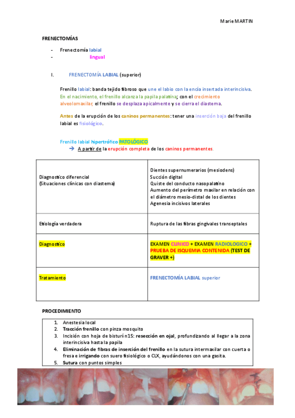 Miniatura del documento FRENECTOMIAS.pdf