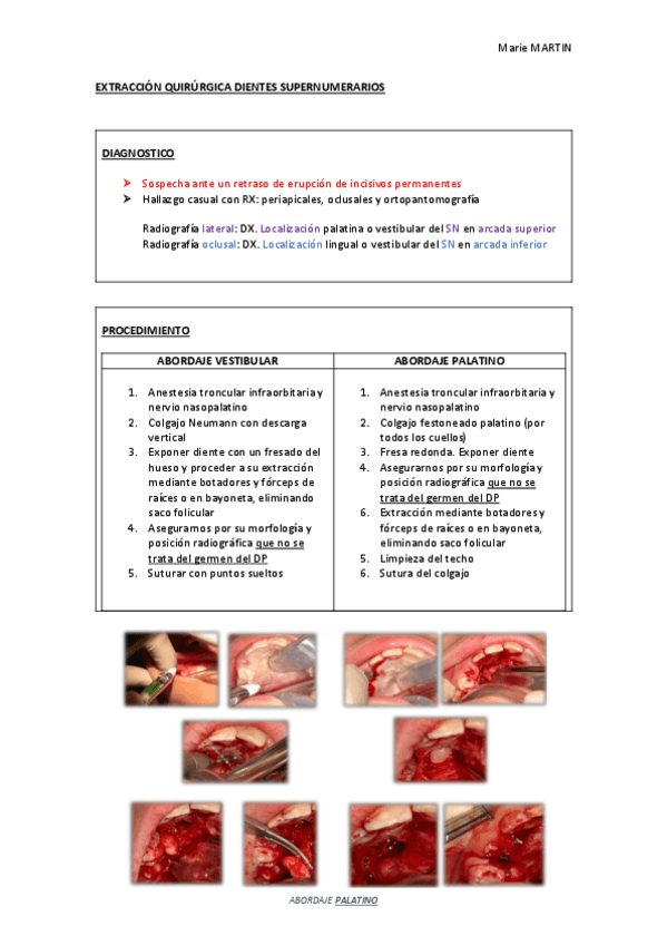 Miniatura del documento EXTRACCION-QUIRURGICA-DIENTES-SUPERNUMERARIOS.pdf