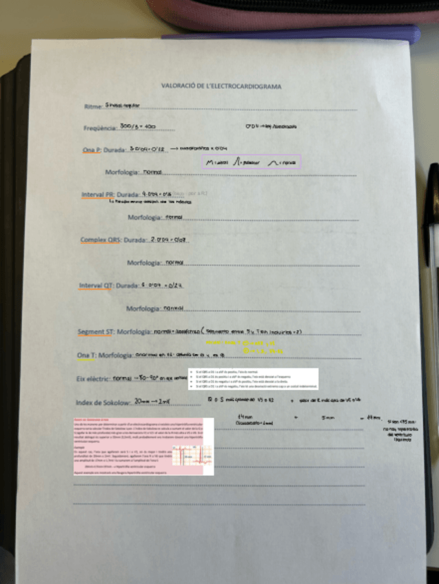 Miniatura del documento PRACTICA-ECG.pdf