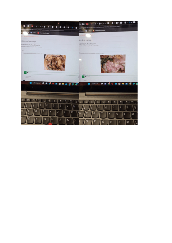 Miniatura del documento Test-practica-Ap-digestivo.pdf