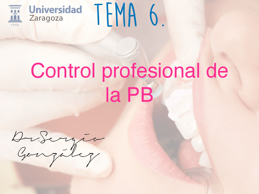 Miniatura del documento Tema-6.-Control-profesional-de-la-PB.-key-1.pdf