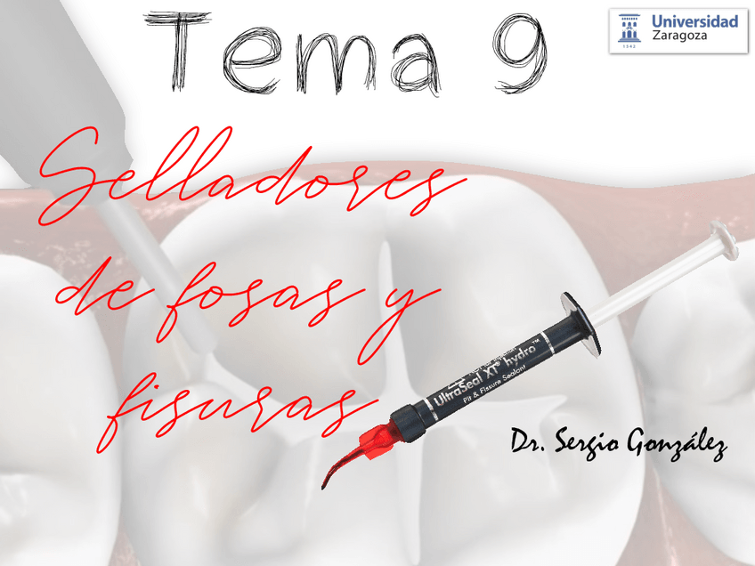 Miniatura del documento Tema-9.-selladores.pdf