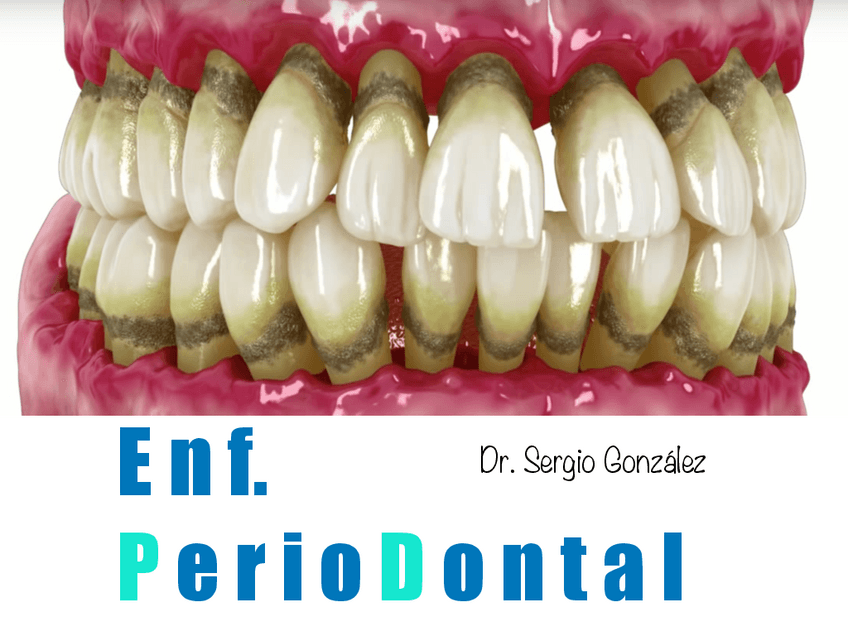 Miniatura del documento Tema-10.-enfermedad-periodontal.pdf