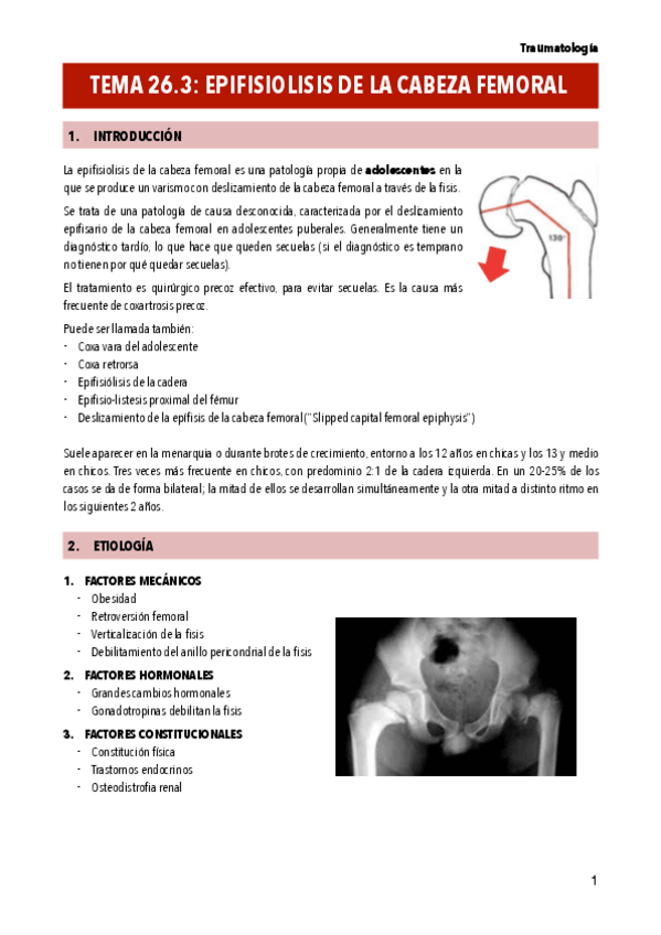 Miniatura del documento T26.3-EPIFISIOLISIS-DE-LA-CABEZA-FEMORAL.pdf