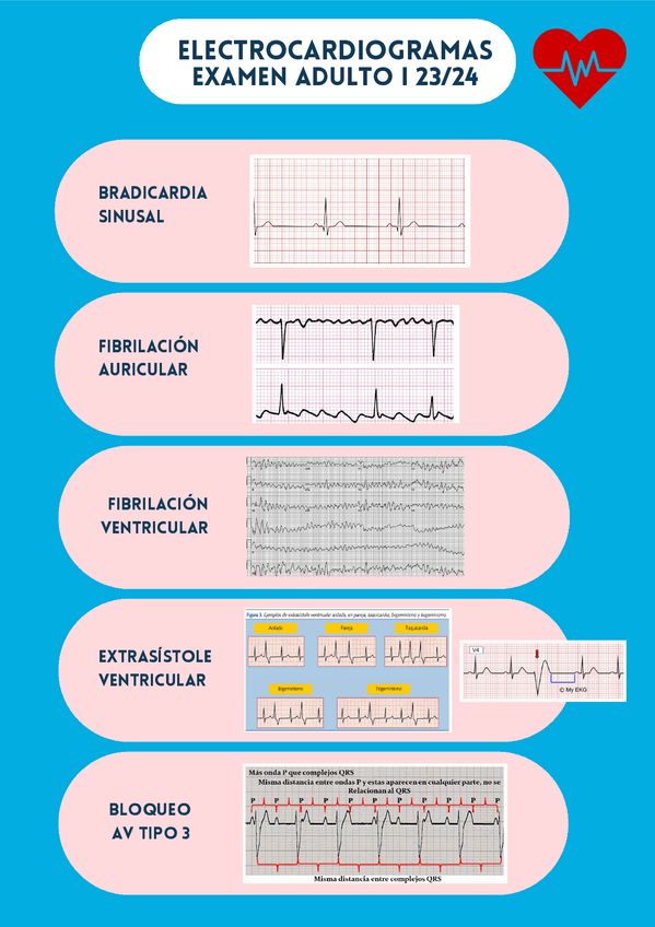Miniatura del documento electros-EXAMEN-ADULTO-I-2324.pdf